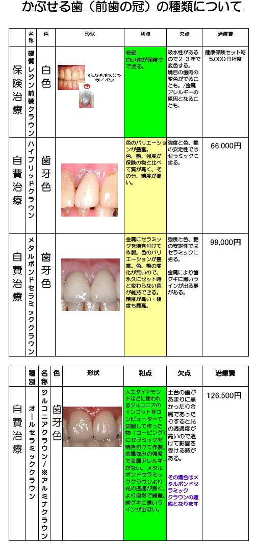 かぶせる歯（前歯の冠）の種類